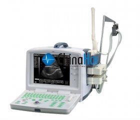 Portable Ultrasound Scanner (Digital)